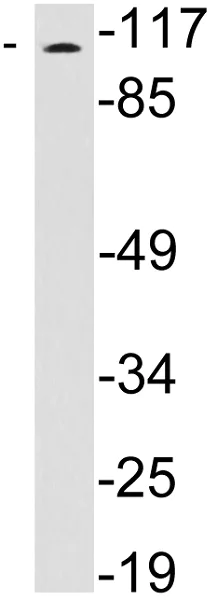 Western blot - Anti-WFS1 antibody (AB230512)