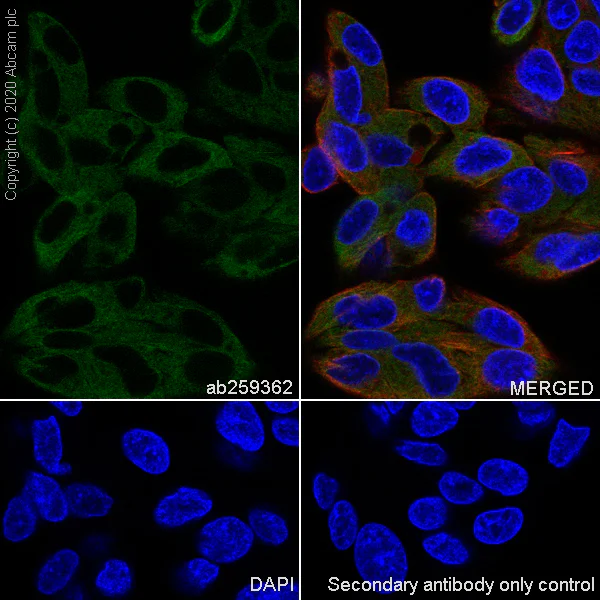 Immunocytochemistry/ Immunofluorescence - Anti-WFS1 antibody [EPR23801-91] - BSA and Azide free (AB280571)
