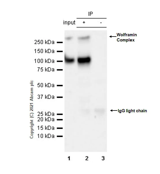 Immunoprecipitation - Anti-WFS1 antibody [EPR23801-91] - BSA and Azide free (AB280571)