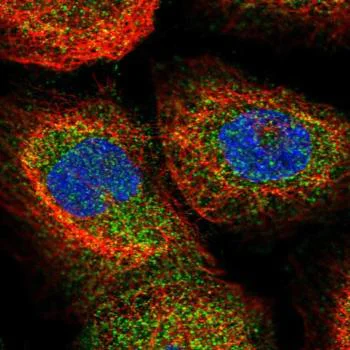 Immunocytochemistry - Anti-WHAMM antibody (AB122572)