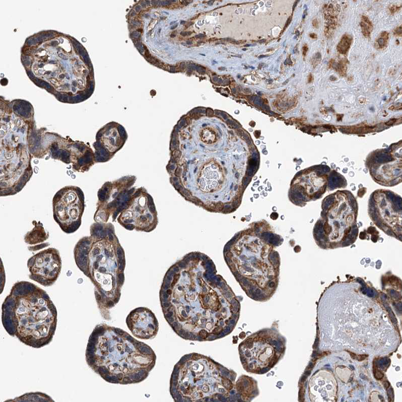 Immunohistochemistry (Formalin/PFA-fixed paraffin-embedded sections) - Anti-WHAMM antibody (AB122572)