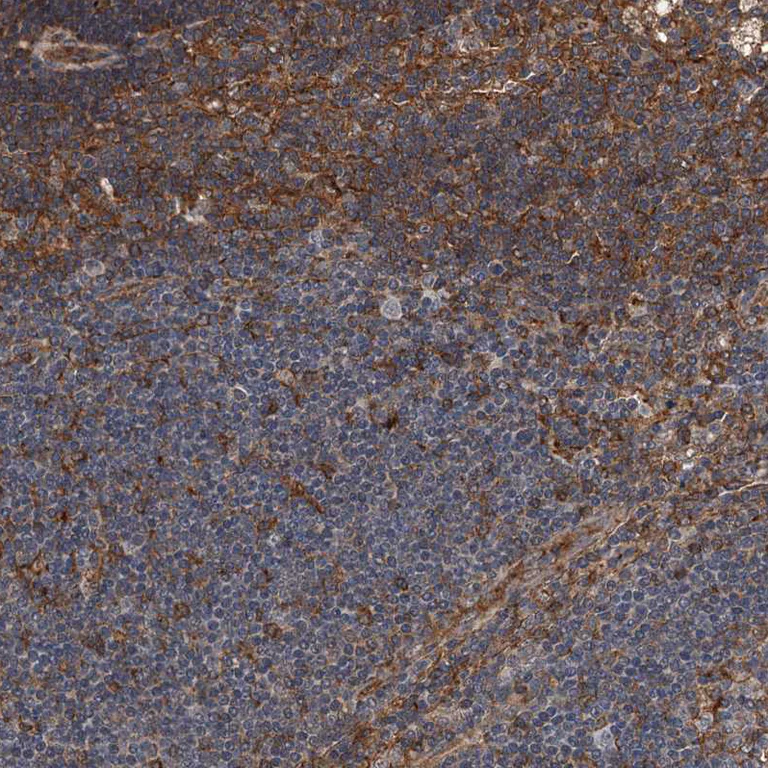 Immunohistochemistry (Formalin/PFA-fixed paraffin-embedded sections) - Anti-WHAMM antibody (AB122572)