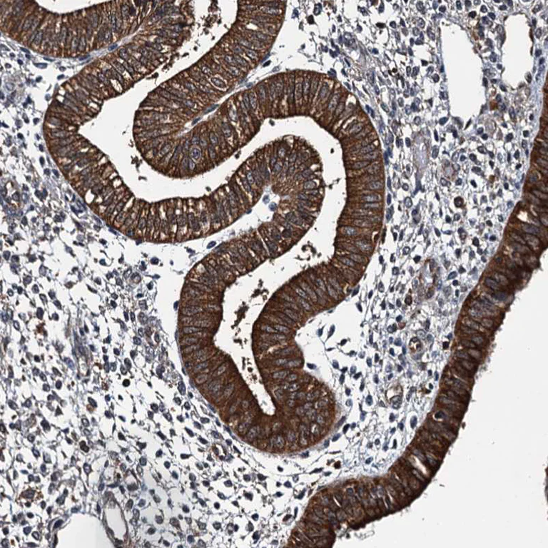 Immunohistochemistry (Formalin/PFA-fixed paraffin-embedded sections) - Anti-WHAMM antibody (AB122572)