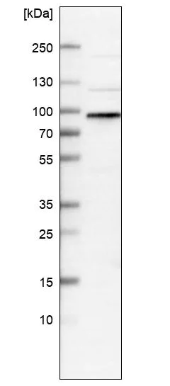 Western blot - Anti-WHAMM antibody (AB122572)