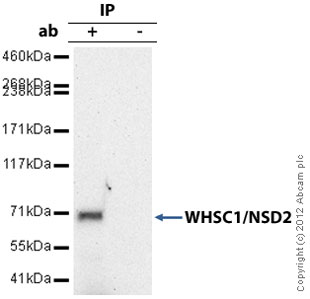 Immunoprecipitation - Anti-WHSC1/NSD2 antibody [29D1] (AB75359), expandable thumbnail
