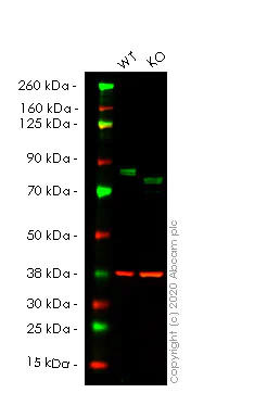 Western blot - Anti-WHSC1/NSD2 antibody [29D1] (AB75359)
