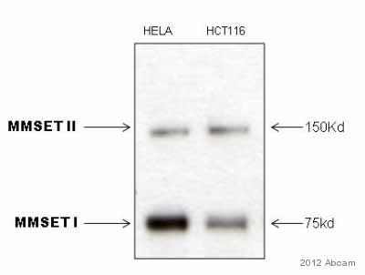 Western blot - Anti-WHSC1/NSD2 antibody [29D1] (AB75359), expandable thumbnail