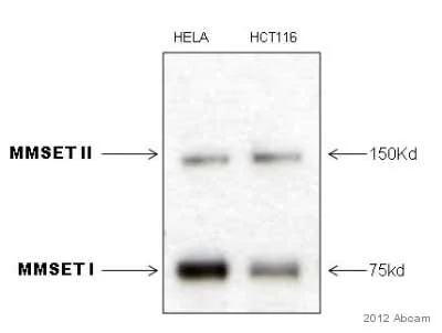 Western blot - Anti-WHSC1/NSD2 antibody [29D1] (AB75359)