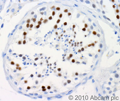 Immunohistochemistry (Formalin/PFA-fixed paraffin-embedded sections) - Anti-WHSC1/NSD2 antibody [29D1] - BSA and Azide free (AB235726)