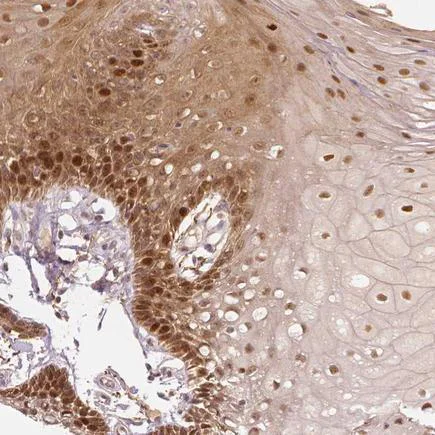 Immunohistochemistry (Formalin/PFA-fixed paraffin-embedded sections) - Anti-WHSC1/NSD2 antibody (AB223694)