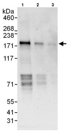 Western blot - Anti-WHSC1/NSD2 antibody (AB225625)