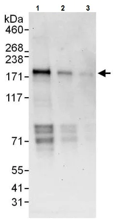 Western blot - Anti-WHSC1/NSD2 antibody (AB225625)