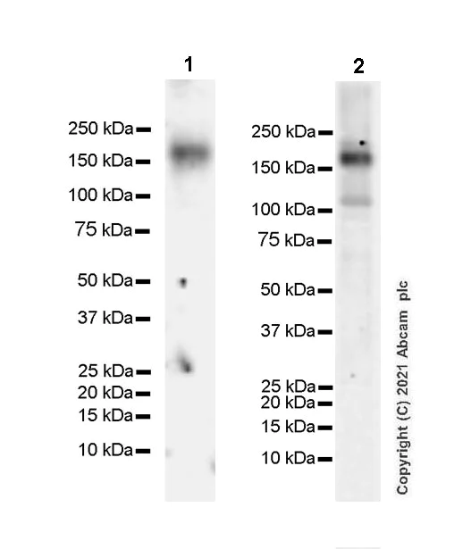 Western blot - Anti-WHSC1/NSD2 antibody [EPR23777-107] - BSA and Azide free (AB283584)