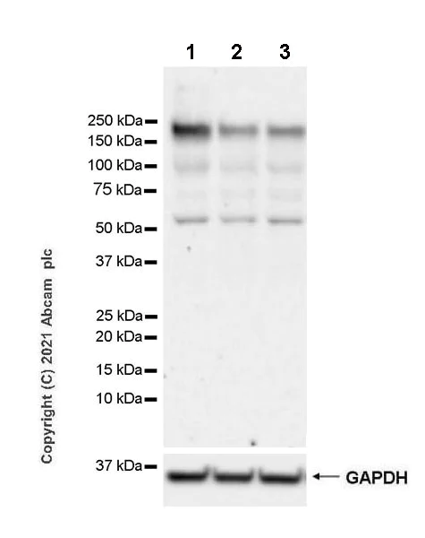 Western blot - Anti-WHSC1/NSD2 antibody [EPR23777-107] - BSA and Azide free (AB283584)
