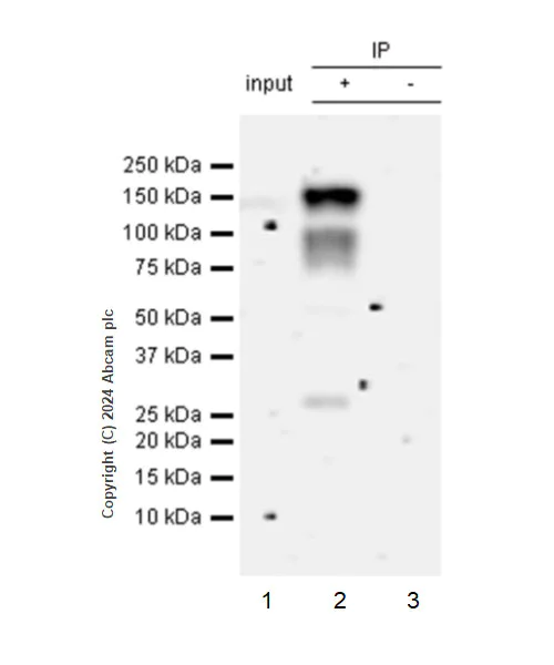 Immunoprecipitation - Anti-WHSC1/NSD2 antibody [EPR23777-95] (AB317010)