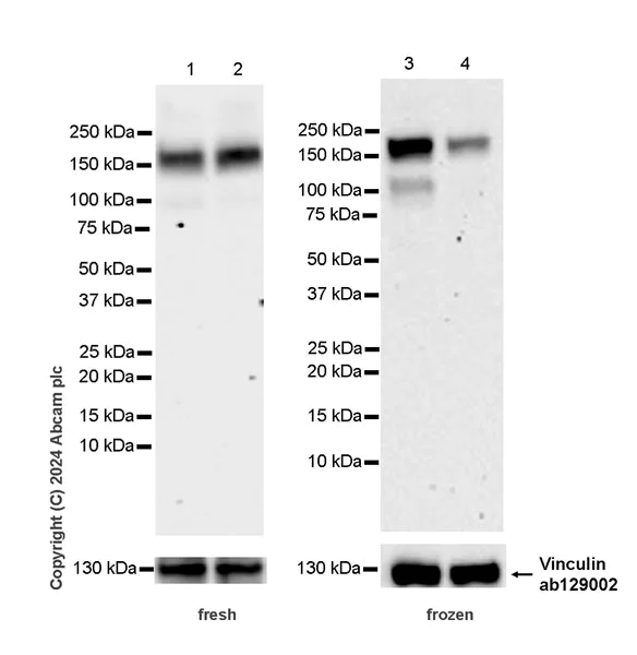 Western blot - Anti-WHSC1/NSD2 antibody [EPR23777-95] (AB317010)