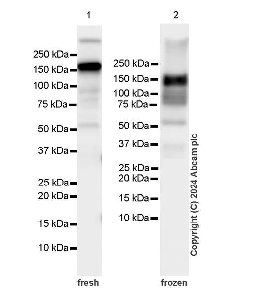 Western blot - Anti-WHSC1/NSD2 antibody [EPR23777-95] (AB317010)