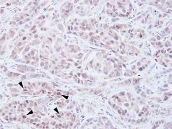 Immunohistochemistry (Formalin/PFA-fixed paraffin-embedded sections) - Anti-WHSC1/NSD2 antibody - N-terminal (AB137429)
