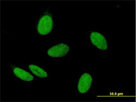 Immunocytochemistry/ Immunofluorescence - Anti-WHSC2/NELF-A antibody (AB167675)