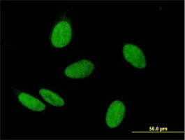 Immunocytochemistry/ Immunofluorescence - Anti-WHSC2/NELF-A antibody (AB167675)