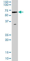 Western blot - Anti-WHSC2/NELF-A antibody (AB167675)