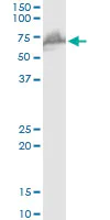 Western blot - Anti-WHSC2/NELF-A antibody (AB167675)