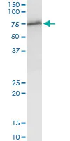 Western blot - Anti-WHSC2/NELF-A antibody (AB167675)