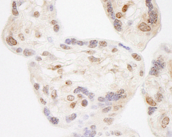 Immunohistochemistry (Formalin/PFA-fixed paraffin-embedded sections) - Anti-WHSC2/NELF-A antibody (AB85852)