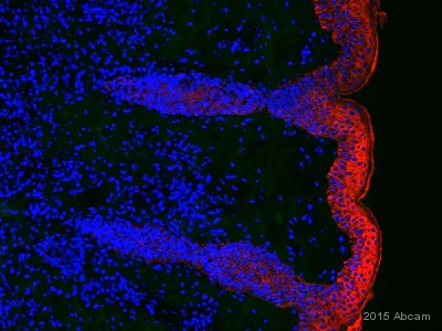 Wide spectrum cytokeratin antibody - rabbit polyclonal
