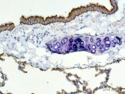 Immunohistochemistry (Formalin/PFA-fixed paraffin-embedded sections) - Anti-wide spectrum Cytokeratin antibody (AB9377)