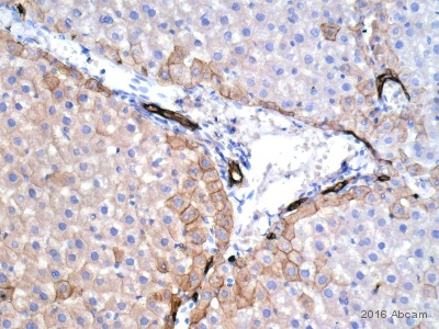 Immunohistochemistry (Formalin/PFA-fixed paraffin-embedded sections) - Anti-wide spectrum Cytokeratin antibody (AB9377), expandable thumbnail