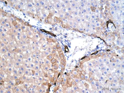 Wide spectrum cytokeratin antibody - rabbit polyclonal