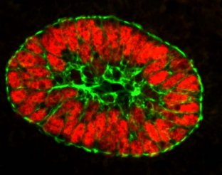 Immunohistochemistry (Formalin/PFA-fixed paraffin-embedded sections) - Anti-wide spectrum Cytokeratin antibody (AB9377), expandable thumbnail