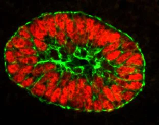 Immunohistochemistry (Formalin/PFA-fixed paraffin-embedded sections) - Anti-wide spectrum Cytokeratin antibody (AB9377)