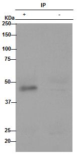 Immunoprecipitation - Anti-WIF1 antibody [EPR9385] (AB155101)