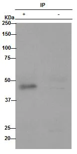 Immunoprecipitation - Anti-WIF1 antibody [EPR9385] (AB155101)
