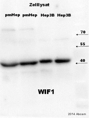 Western blot - Anti-WIF1 antibody [EPR9385] (AB155101)