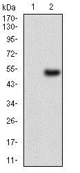 Western blot - Anti-Wilms Tumor Protein antibody [5G11A5] (AB201948), expandable thumbnail