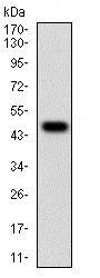 Western blot - Anti-Wilms Tumor Protein antibody [5G11A5] (AB201948), expandable thumbnail