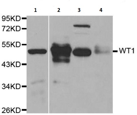 Western blot - Anti-Wilms Tumor Protein antibody (AB180840), expandable thumbnail