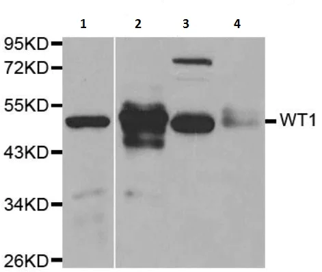 Western blot - Anti-Wilms Tumor Protein antibody (AB180840)