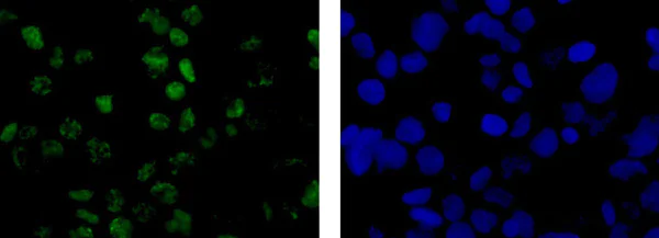 Immunocytochemistry/ Immunofluorescence - Anti-Wilms Tumor Protein antibody [CAN-R9(IHC)-56-2] (AB89901)