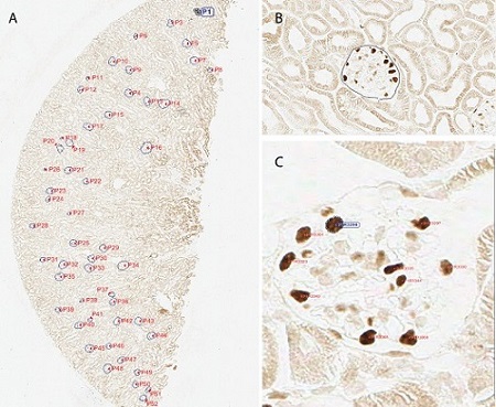 Immunohistochemistry (Formalin/PFA-fixed paraffin-embedded sections) - Anti-Wilms Tumor Protein antibody [CAN-R9(IHC)-56-2] (AB89901), expandable thumbnail