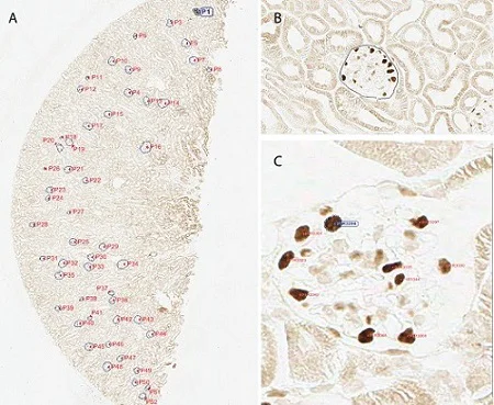 Immunohistochemistry (Formalin/PFA-fixed paraffin-embedded sections) - Anti-Wilms Tumor Protein antibody [CAN-R9(IHC)-56-2] (AB89901)