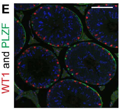 Immunohistochemistry (Formalin/PFA-fixed paraffin-embedded sections) - Anti-Wilms Tumor Protein antibody [CAN-R9(IHC)-56-2] (AB89901), expandable thumbnail