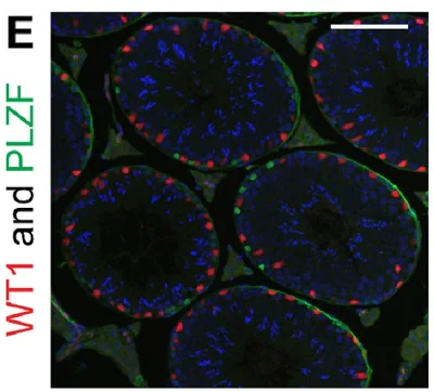 Immunohistochemistry (Formalin/PFA-fixed paraffin-embedded sections) - Anti-Wilms Tumor Protein antibody [CAN-R9(IHC)-56-2] (AB89901)