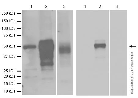 Western blot - Anti-Wilms Tumor Protein antibody [CAN-R9(IHC)-56-2] (AB89901)