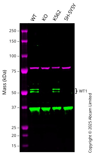 Western blot - Anti-Wilms Tumor Protein antibody [CAN-R9(IHC)-56-2] (ab89901), expandable thumbnail