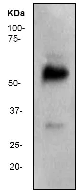 Western blot - Anti-Wilms Tumor Protein antibody [CAN-R9(IHC)-56-2] (AB89901)