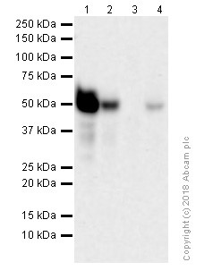 Western blot - Anti-Wilms Tumor Protein antibody [CAN-R9(IHC)-56-2] (ab89901), expandable thumbnail